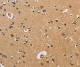 Anti-Human CST6 Antibody - ABMIUM