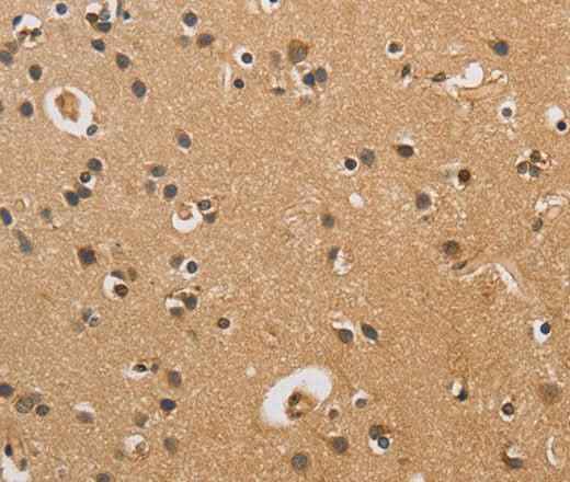 Anti-Human CST6 Antibody