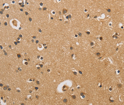 Anti-Human CST6 Antibody - ABMIUM