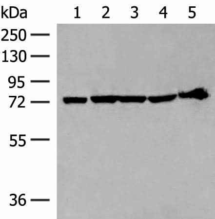 Anti-Human/Mouse/Rat CALCOCO1 Antibody