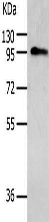 Anti-Human AKAP8 Antibody - ABMIUM