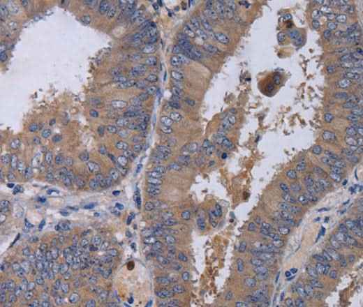 Anti-Human MKKS Antibody