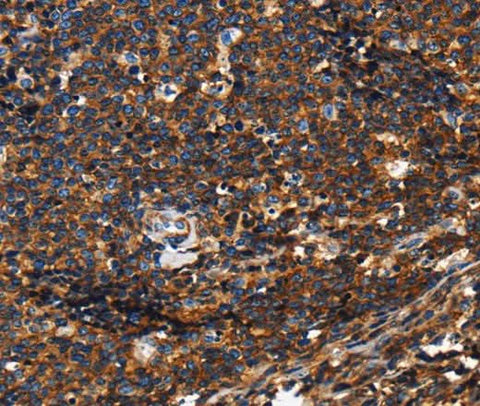 Anti-Human/Mouse/Rat PTPRC Antibody - ABMIUM