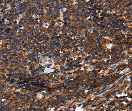 Anti-Human/Mouse/Rat PTPRC Antibody - ABMIUM