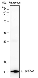 Anti-Human/Rat/Mouse S100A8 Antibody [A427]