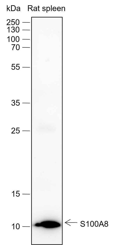 Anti-Human/Rat/Mouse S100A8 Antibody [A427] - ABMIUM