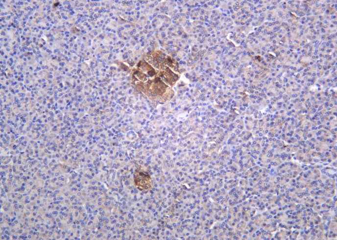 Anti-Human/Mouse/Rat Glucagon Antibody [B1015] - ABMIUM