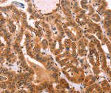 Anti-Human PROS1 Antibody - ABMIUM