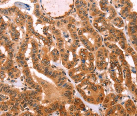 Anti-Human PROS1 Antibody - ABMIUM