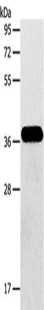 Anti-Human/Mouse/Rat AASDHPPT Antibody - ABMIUM