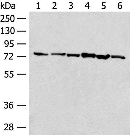 Western blot analysis of 293T cell K562 cell lysates using TCF25 Polyclonal Antibody at dilution of 1:250
