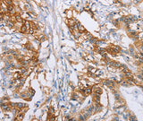 Anti-Human CA9 Antibody - ABMIUM