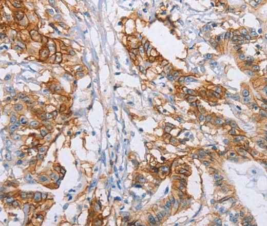 Anti-Human CA9 Antibody