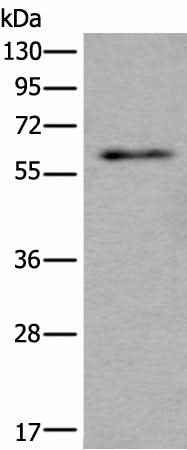 Anti-Human/Mouse/Rat SCP2 Antibody
