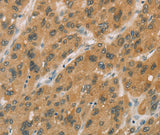 Anti-Human CYP11A1 Antibody - ABMIUM