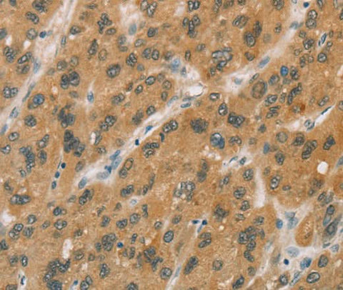 Anti-Human CYP11A1 Antibody - ABMIUM