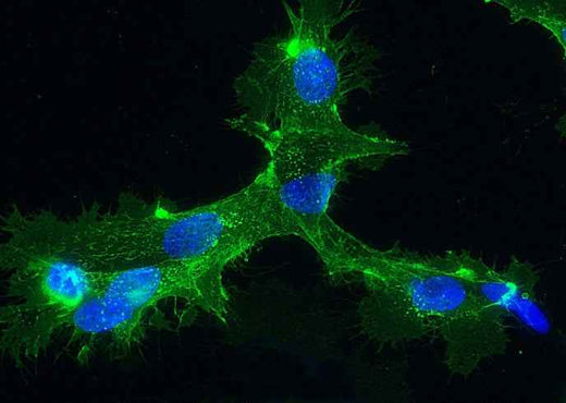 Anti-Human SELE Antibody [B244] - ABMIUM