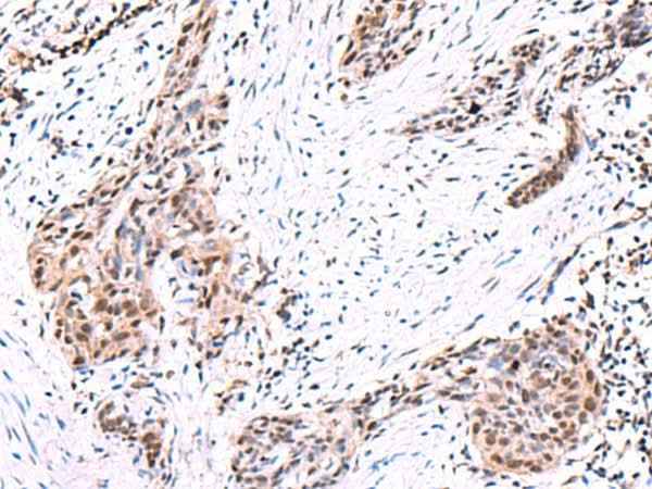 Anti-Human/Mouse/Rat POLD2 Antibody