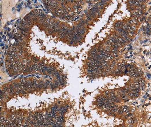 Anti-Human/Mouse/Rat LRRC57 Antibody