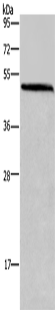 Anti-Human/Mouse/Rat HOMER1 Antibody - ABMIUM