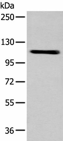 Western blot analysis of A549 cell using ZNF281 Polyclonal Antibody at dilution of 1:600