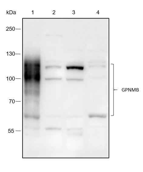 Anti-Human/Mouse GPNMB Antibody [A239] - ABMIUM