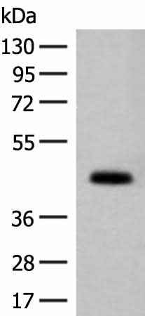 Anti-Human/Mouse GPA33 Antibody