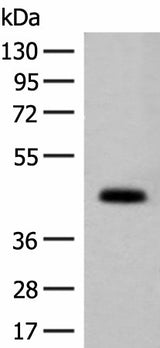 Western blot analysis of Mouse small intestines tissue lysate using GPA33 Polyclonal Antibody at dilution of 1:200