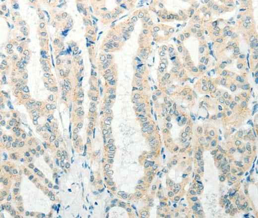 Anti-Human/Mouse RAB25 Antibody