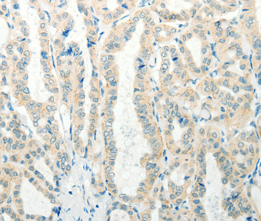 Anti-Human/Mouse RAB25 Antibody - ABMIUM