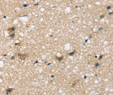 Anti-Human SEMA4A Antibody - ABMIUM
