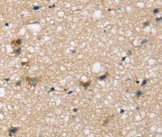 Anti-Human SEMA4A Antibody