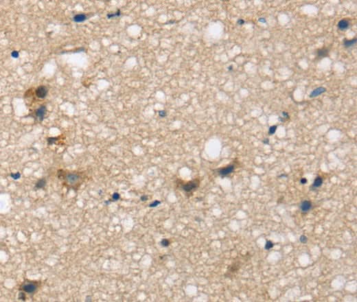 Anti-Human SEMA4A Antibody - ABMIUM