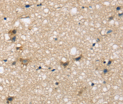 Anti-Human SEMA4A Antibody - ABMIUM