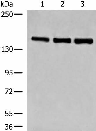 Anti-Human/Mouse LPIN1 Antibody - ABMIUM