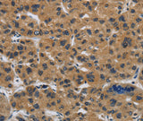 Anti-Human CLDN2 Antibody - ABMIUM