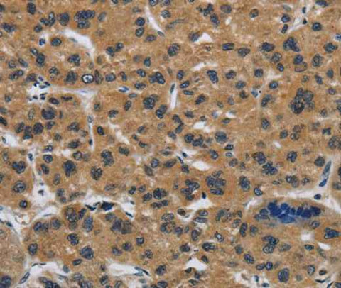 Anti-Human CLDN2 Antibody