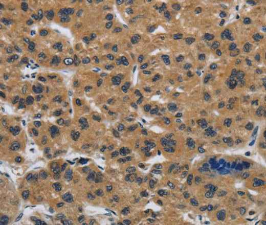 Anti-Human CLDN2 Antibody