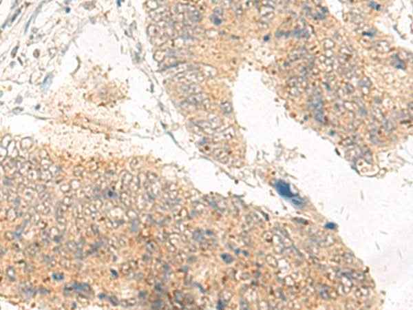 Anti-Human/Mouse IDUA Antibody