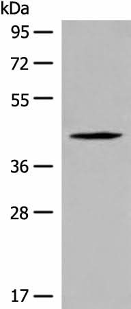 Western blot analysis of Jurkat cell lysate using QTRT1 Polyclonal Antibody at dilution of 1:450