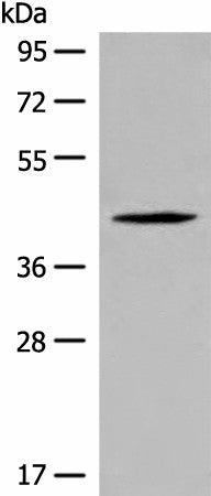 Western blot analysis of Jurkat cell lysate using QTRT1 Polyclonal Antibody at dilution of 1:450