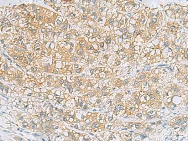Anti-Human/Mouse/Rat EPCAM Antibody