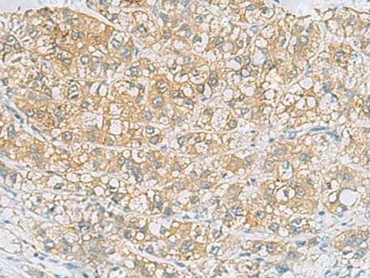Anti-Human/Mouse/Rat EPCAM Antibody