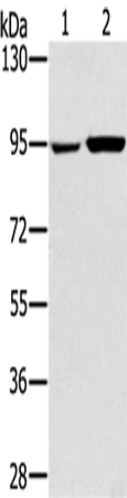Anti-Human/Mouse/Rat PYGL Antibody - ABMIUM