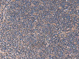 Immunohistochemistry of paraffin-embedded Human tonsil tissue using ITPR2 Polyclonal Antibody at dilution of 1:60(×200)