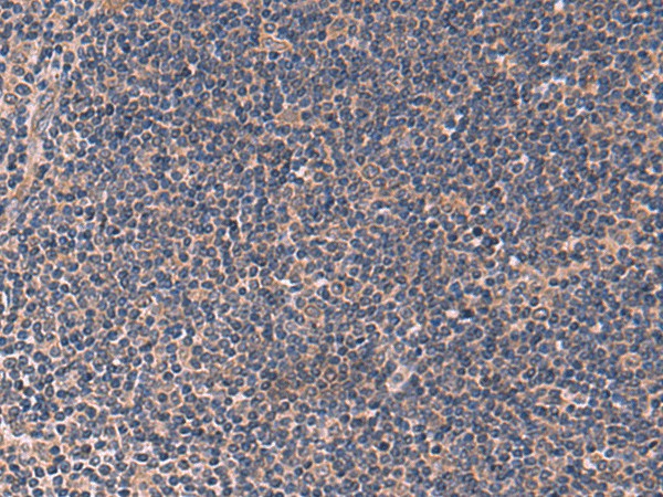 Immunohistochemistry of paraffin-embedded Human tonsil tissue using ITPR2 Polyclonal Antibody at dilution of 1:60(×200)