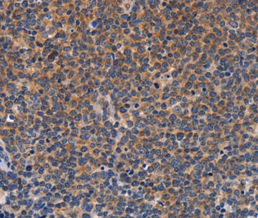 Anti-Human CCL23 Antibody - ABMIUM