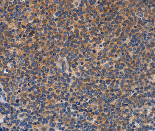 Anti-Human CCL23 Antibody - ABMIUM