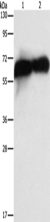 Anti-Human ALPP Antibody - ABMIUM