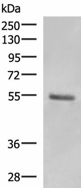 Western blot analysis of Human skin tissue lysate using KRT36 Polyclonal Antibody at dilution of 1:1000